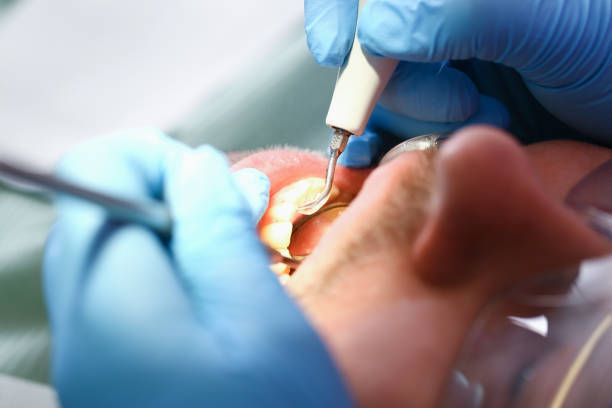 Best Dentist Open Late Near Me  in Winston Salem, NC