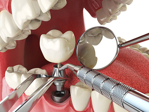 Best Emergency Tooth Extraction  in Winston Salem, NC
